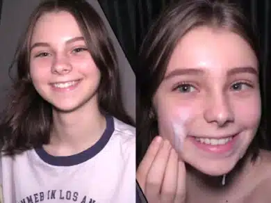 imagen Tratamiento facial para una adolescente de 18 años